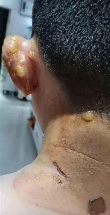 邯郸一小区爆料事件最新,业主维权引发关注,真相究竟如何?